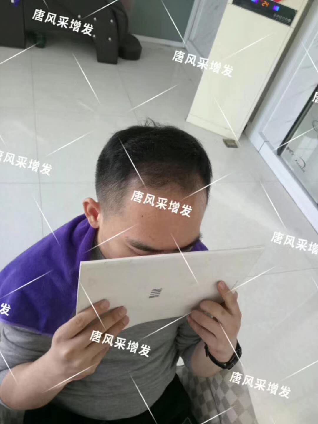 感覺(jué)自尊心好受打擊，朋友說(shuō)我“頭上的油都?jí)虺幢P(pán)菜了...