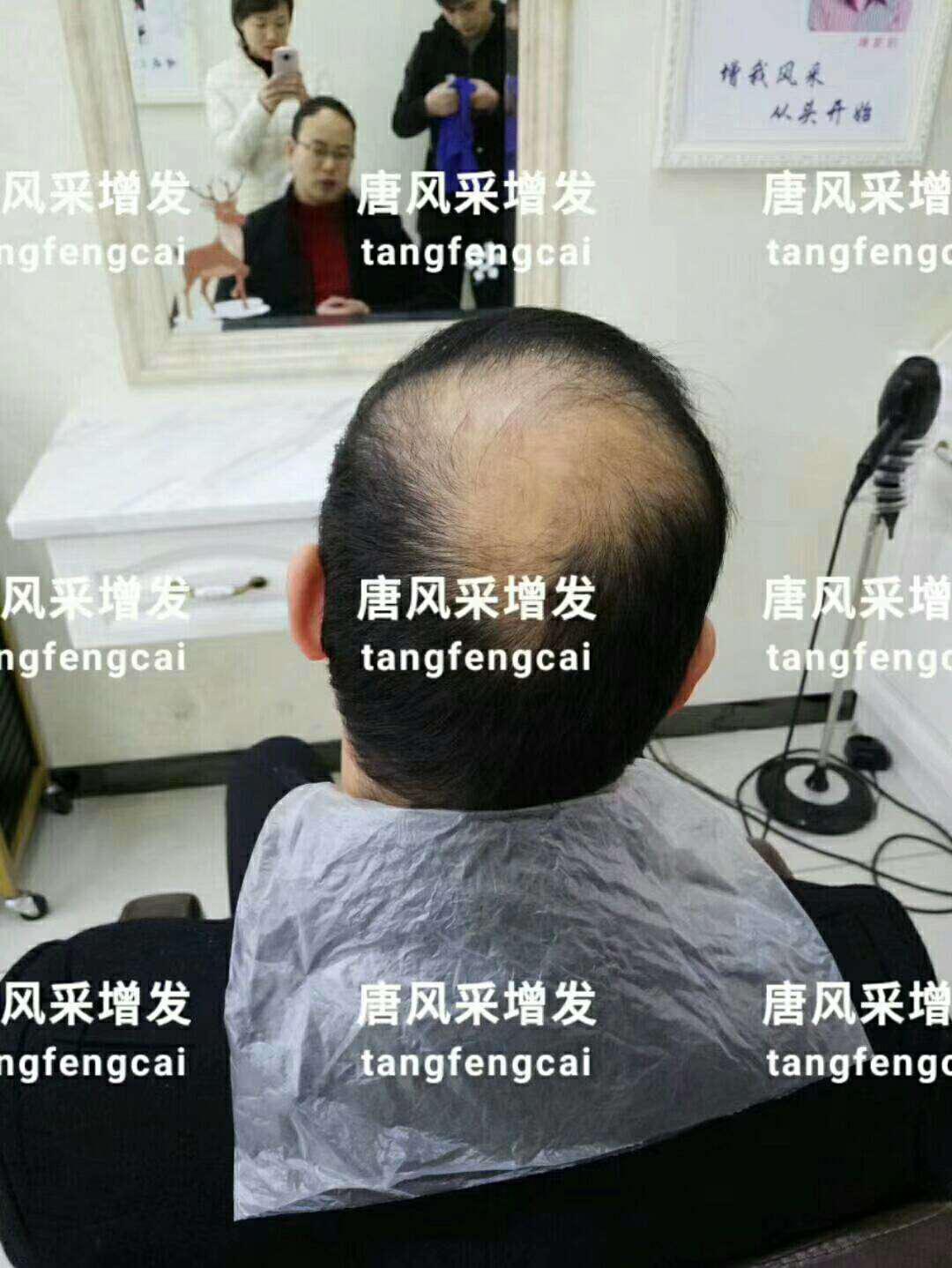  一轉(zhuǎn)眼年輕十歲，你差的就是這點(diǎn)點(diǎn)頭發(fā)！