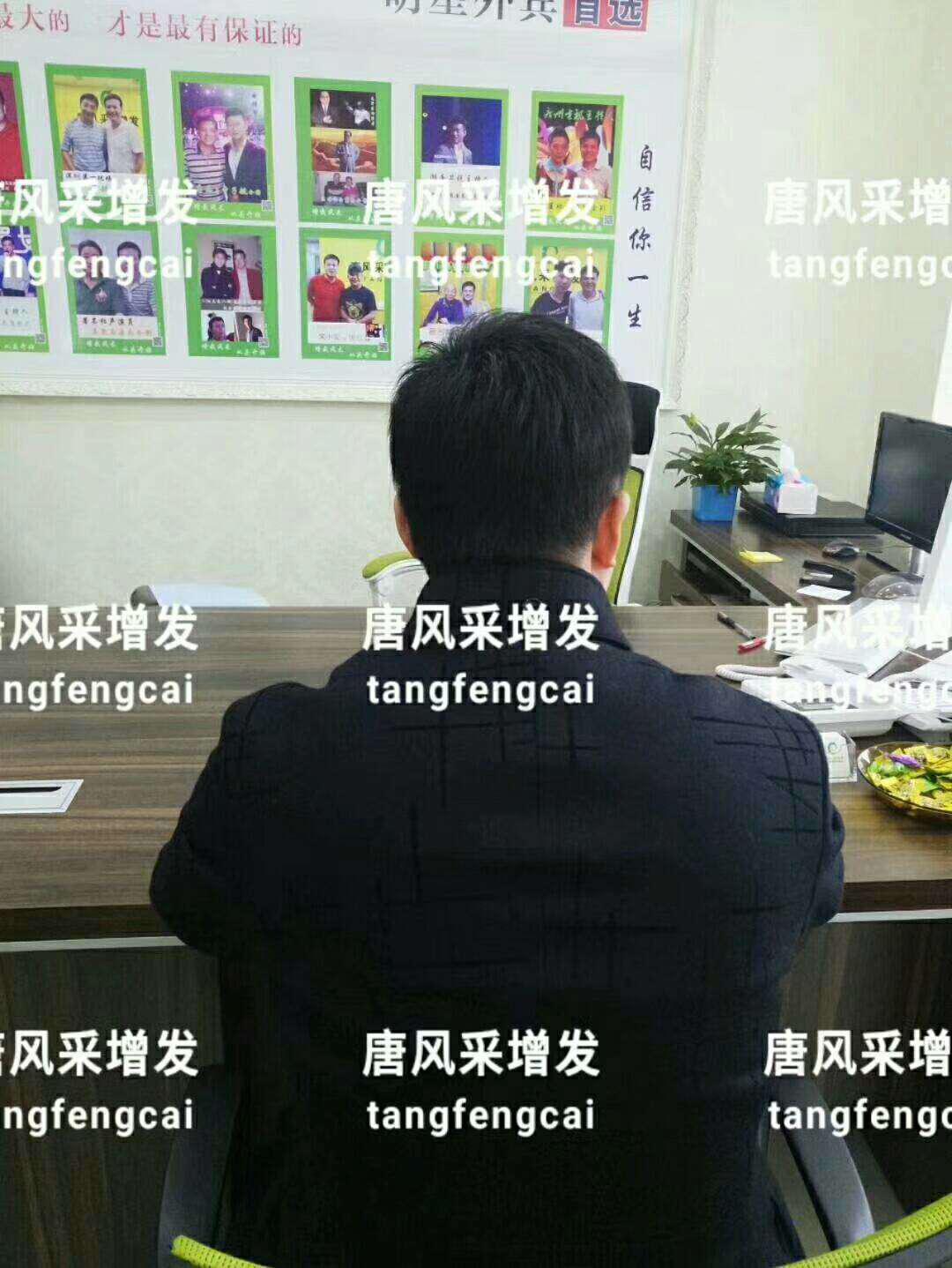  一轉(zhuǎn)眼年輕十歲，你差的就是這點(diǎn)點(diǎn)頭發(fā)！