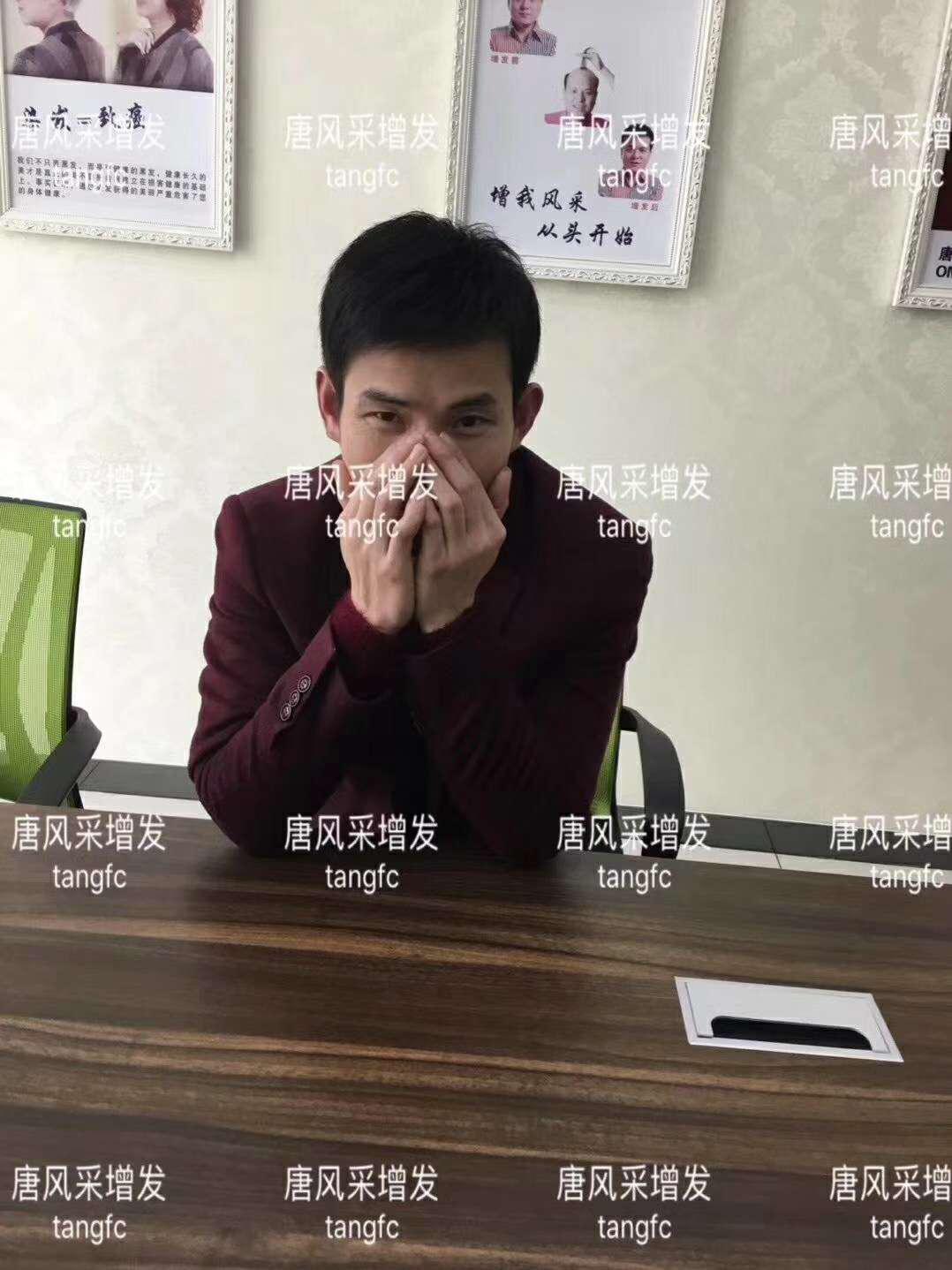  一轉(zhuǎn)眼年輕十歲，你差的就是這點(diǎn)點(diǎn)頭發(fā)！