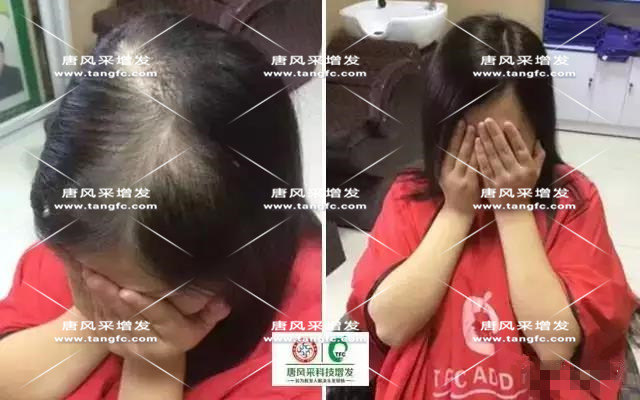 女士假發(fā)見證華麗轉(zhuǎn)變，前后差別震撼！