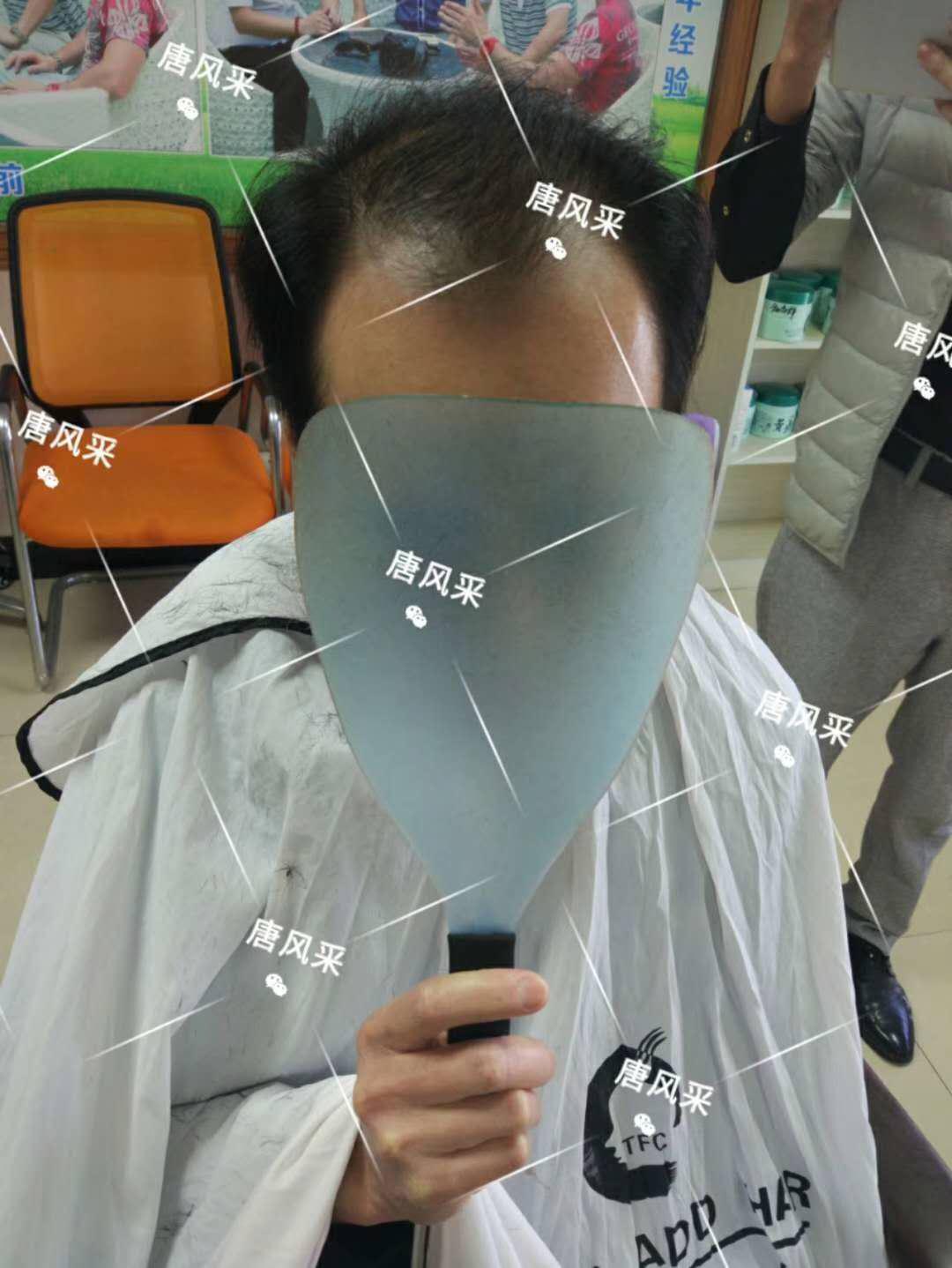 頭發(fā)一洗一大把，猝死不是當(dāng)代年輕人最擔(dān)憂(yōu)的問(wèn)題，而是