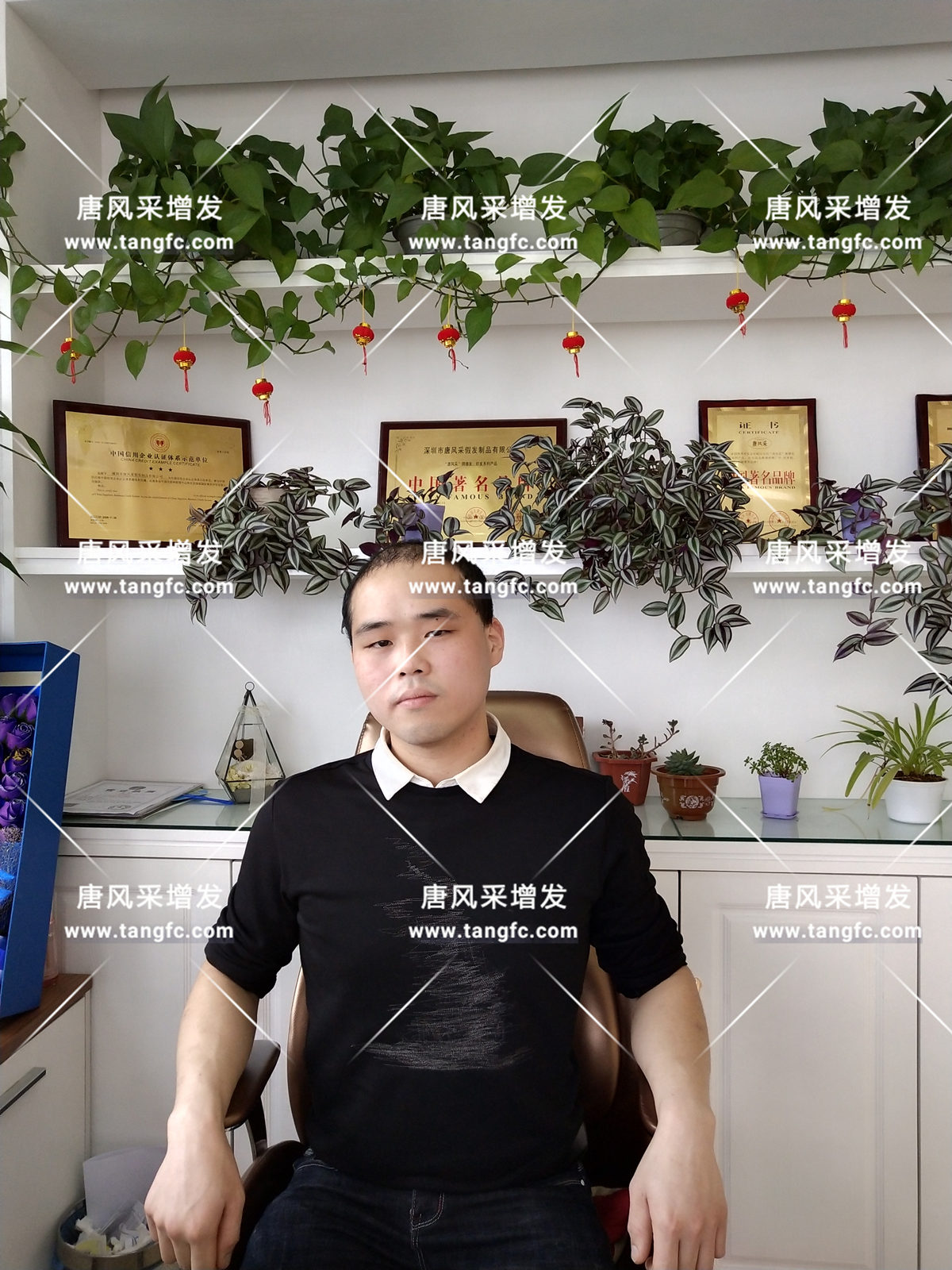 增發(fā)還是植發(fā)，這是個(gè)問題！