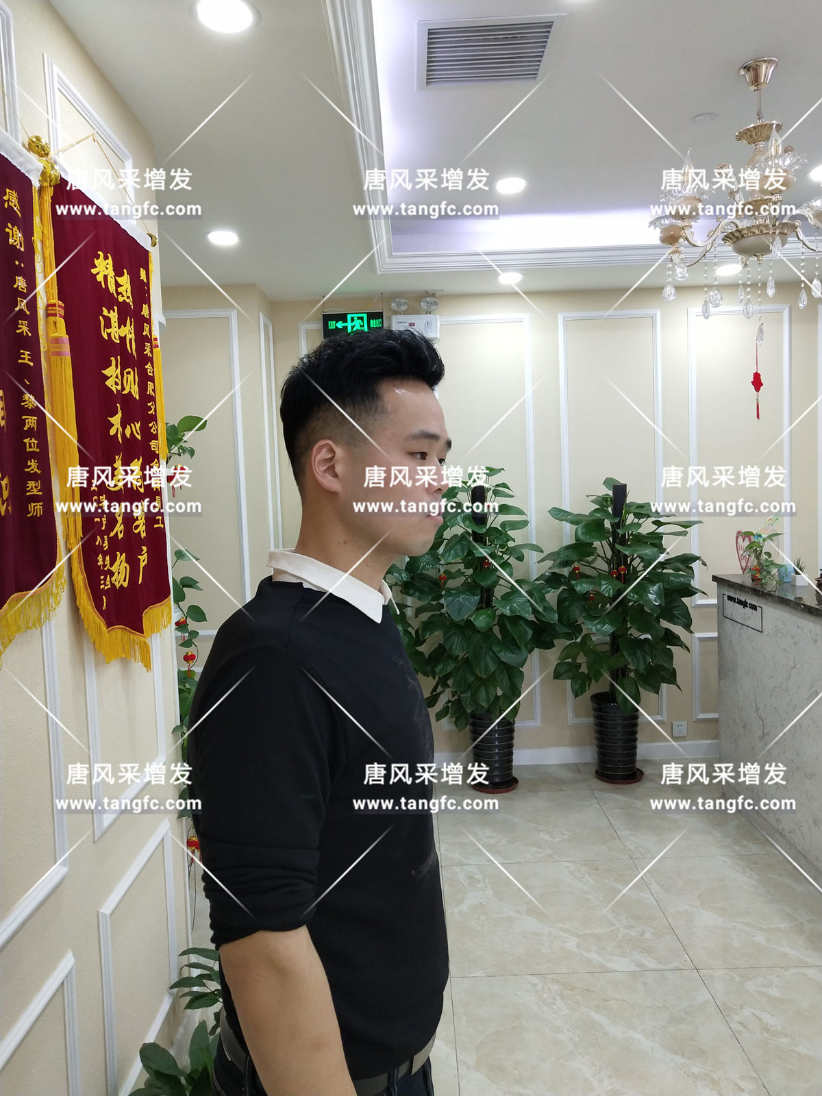 增發(fā)還是植發(fā)，這是個(gè)問題！