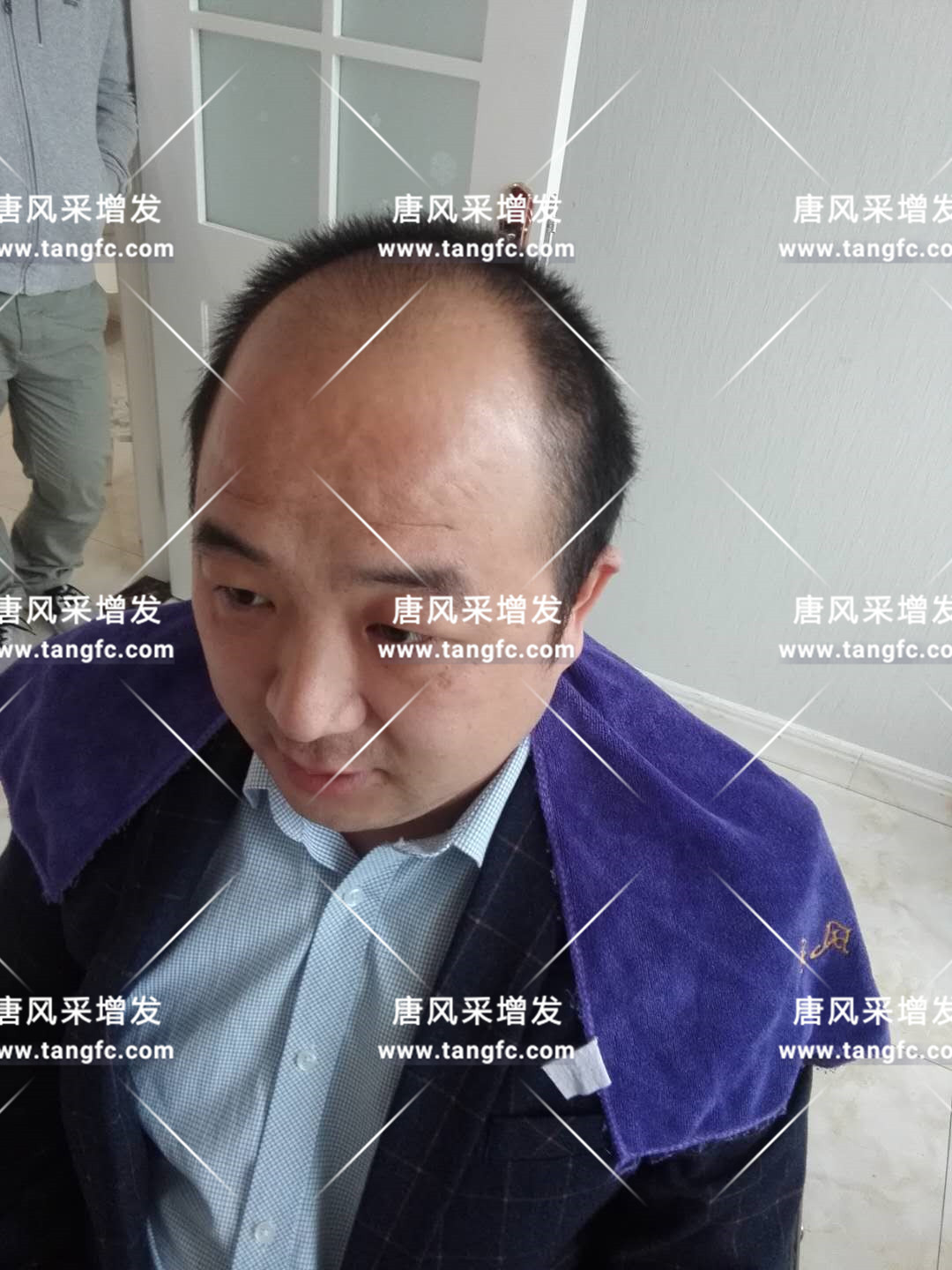 將“脫發(fā)男”變成“型男”模樣，唐風采可以做到！