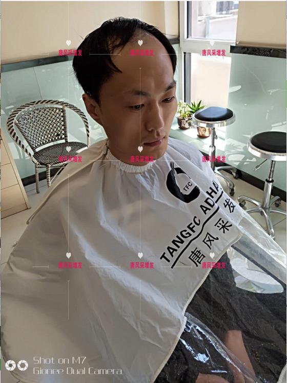 好形象擁抱新生活，唐風(fēng)采助力脫發(fā)新青年！