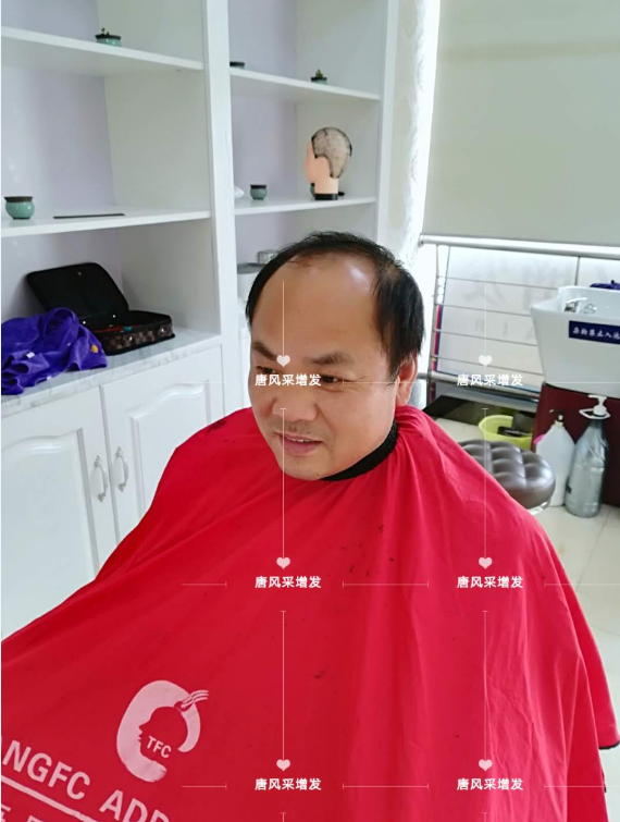 脫發(fā)不分地域，唐風采假發(fā)助力北京爺們