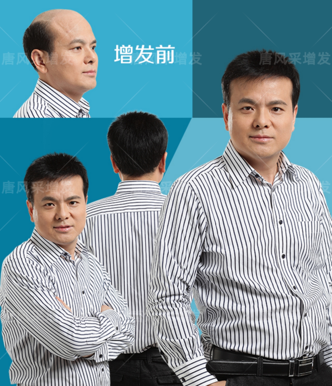 高難度小平頭方案 高難度小平頭方案