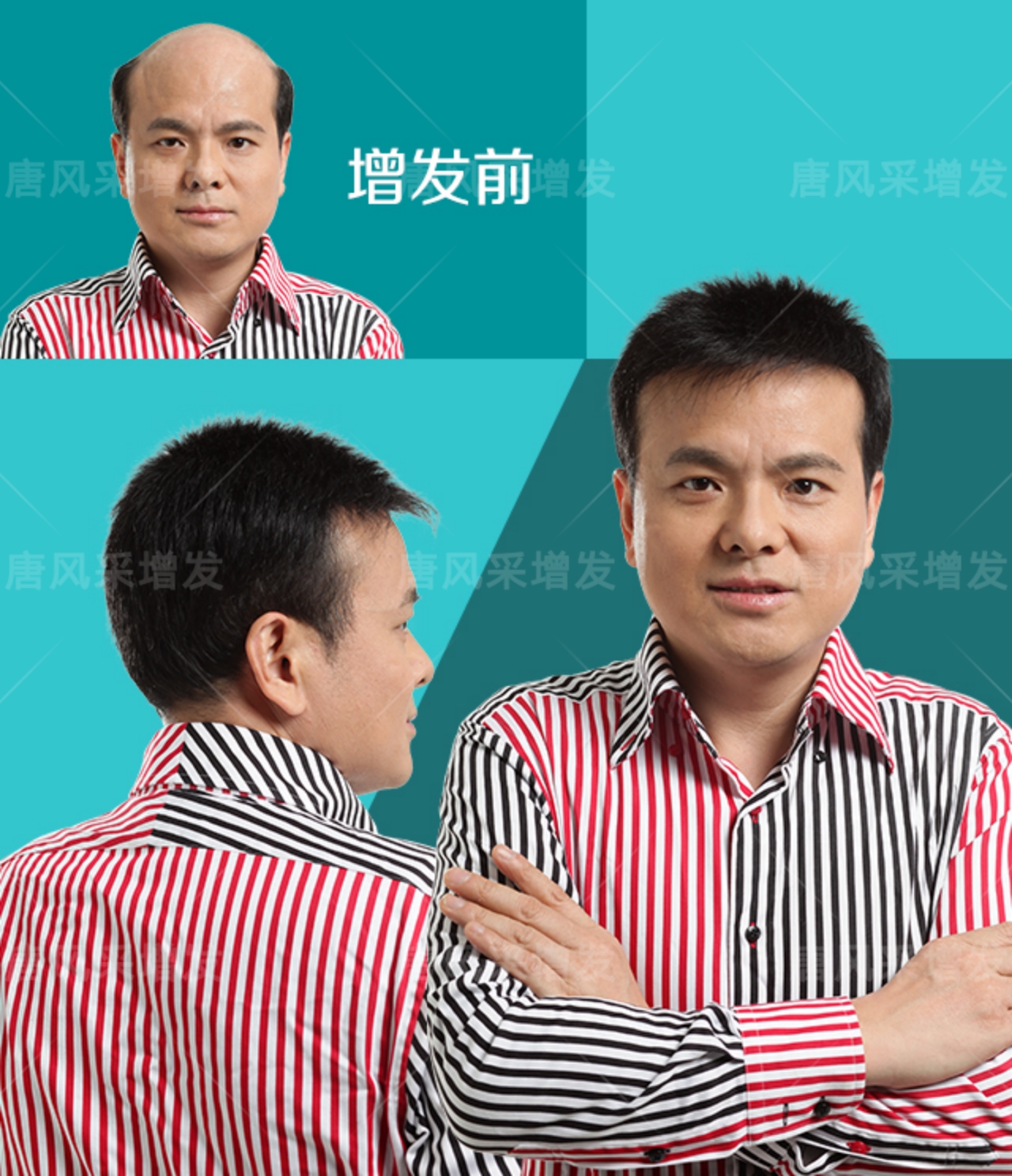 稀發(fā)不哭！終于知道頭發(fā)稀疏可以這樣做！