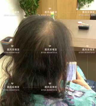 讓頭發(fā)一直好好的，唐風(fēng)采就是這般任性！