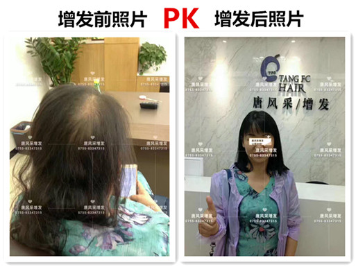 頭發(fā)稀少也能擁有一頭好發(fā)型，不信請(qǐng)看！