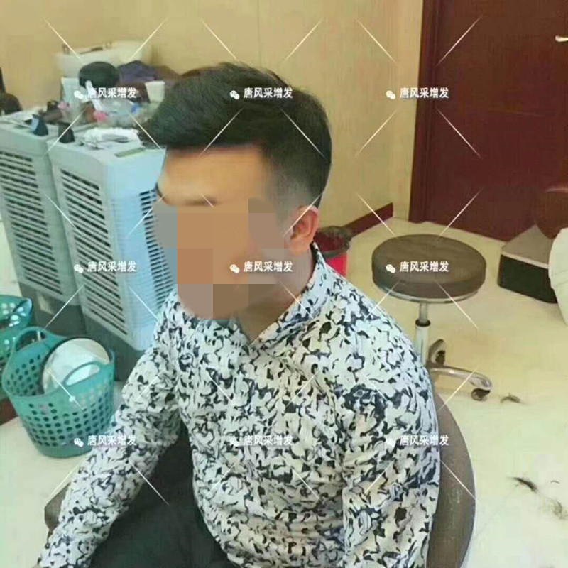 臺(tái)州真發(fā)假發(fā)哪有賣，夏天戴假發(fā)會(huì)悶熱嗎？