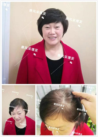 老太太假發(fā)圖片，選擇唐風(fēng)采給自己一個(gè)變年輕的機(jī)會(huì)！