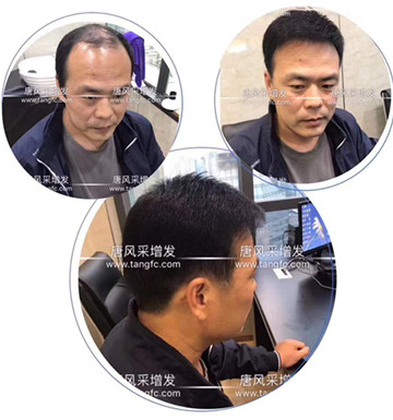 一個(gè)人越是在意的地方，越是令他感到自卑的地方！