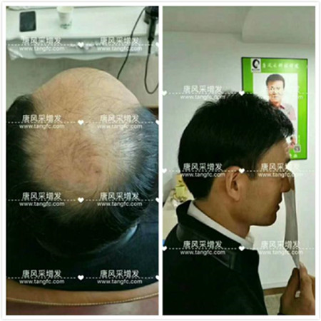 男款假發(fā)品牌哪家好，有用過唐風(fēng)采的嗎？