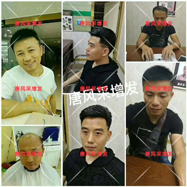 男款假發(fā)品牌哪家好，有用過唐風(fēng)采的嗎？