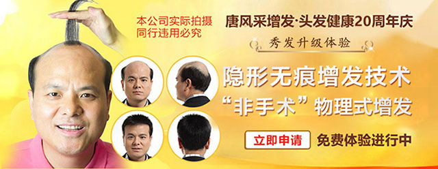 西寧補發(fā)哪里好誰知道？ 90后脫發(fā)了想做補發(fā)！