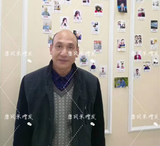 《我不是藥神》火了，山爭哥哥光頭變“藥神”成熱門話題！