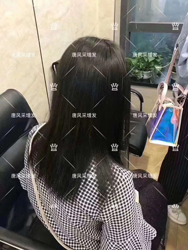 西寧織發(fā)補(bǔ)發(fā)需要多少錢(qián),哪家補(bǔ)發(fā)技術(shù)好？