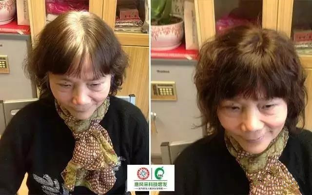 治白發(fā)不如遮白發(fā)，這個方法最有效！