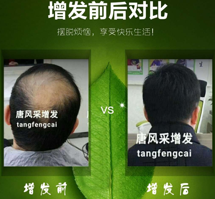 嘉興織發(fā)補(bǔ)發(fā)哪家好？發(fā)友們都“發(fā)”現(xiàn)了這家！