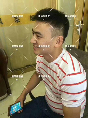 西寧織發(fā)補(bǔ)發(fā)哪家好，真的能改變我的脫發(fā)形象嗎？ 