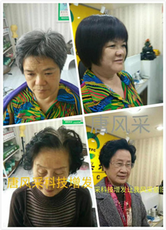 西寧假發(fā)專賣店哪家好，無痕真發(fā)假發(fā)跟一般發(fā)套有區(qū)別嗎