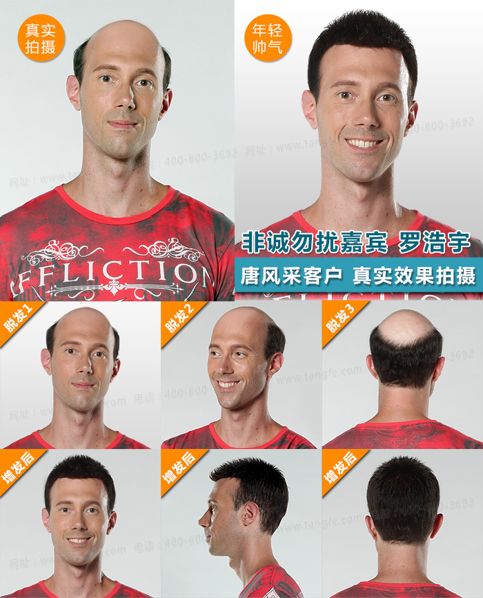 西寧假發(fā)片定制哪家好？ 為什么現(xiàn)在都不買成品假發(fā)了？