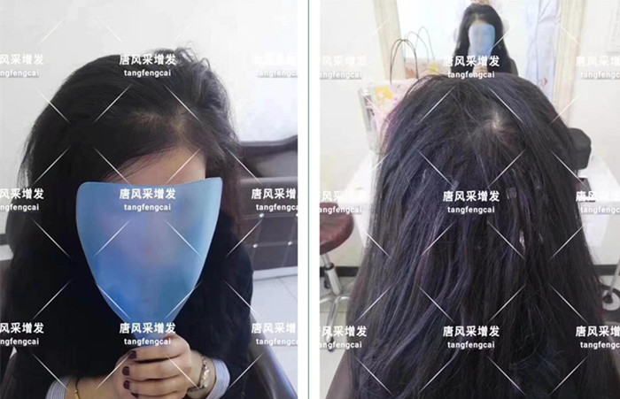 唐風(fēng)采假發(fā)客戶案例