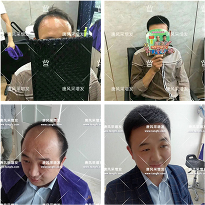 唐風(fēng)采假發(fā)案例