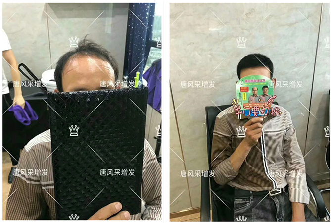 成都逼真的假發(fā)哪里有賣？