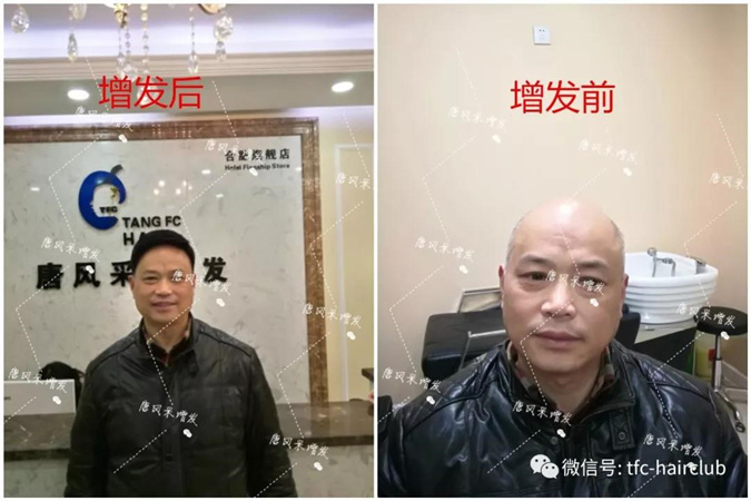 唐風(fēng)采假發(fā)案例