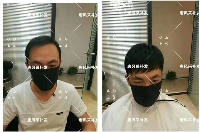 唐風(fēng)采假發(fā)客戶案例