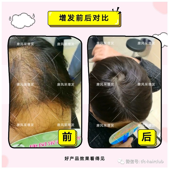 女性加密織發(fā)效果 唐風(fēng)采假發(fā)