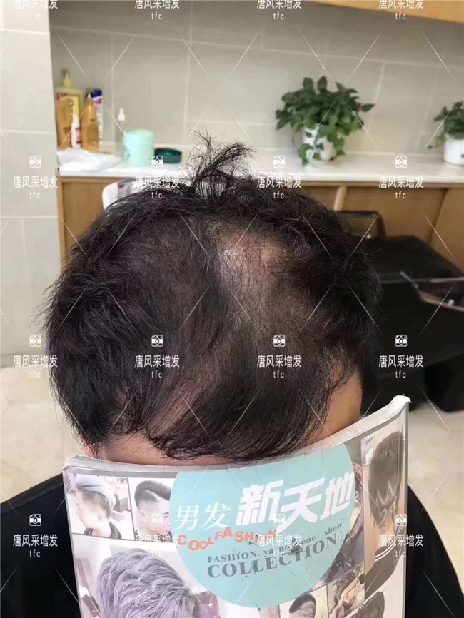 在唐風(fēng)采假發(fā)后