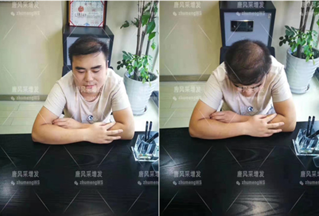 真頭發(fā)發(fā)片 唐風(fēng)采客戶案例