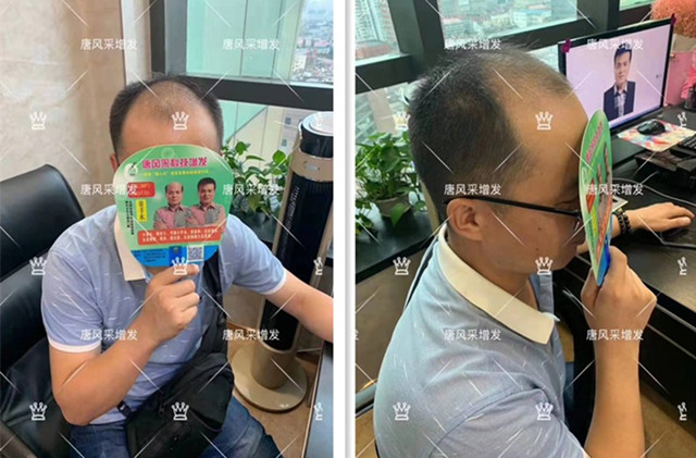無(wú)痕真發(fā)發(fā)片 官方二維碼 唐風(fēng)采客戶案例