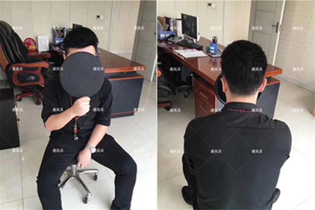 頭頂假發(fā)片 唐風(fēng)采真實(shí)案例