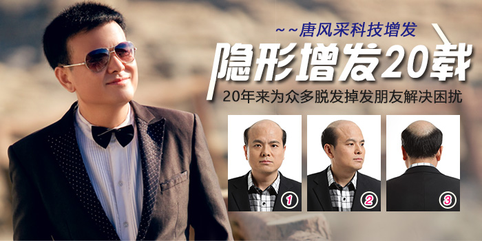 頭頂假發(fā)片 唐風(fēng)采假發(fā)