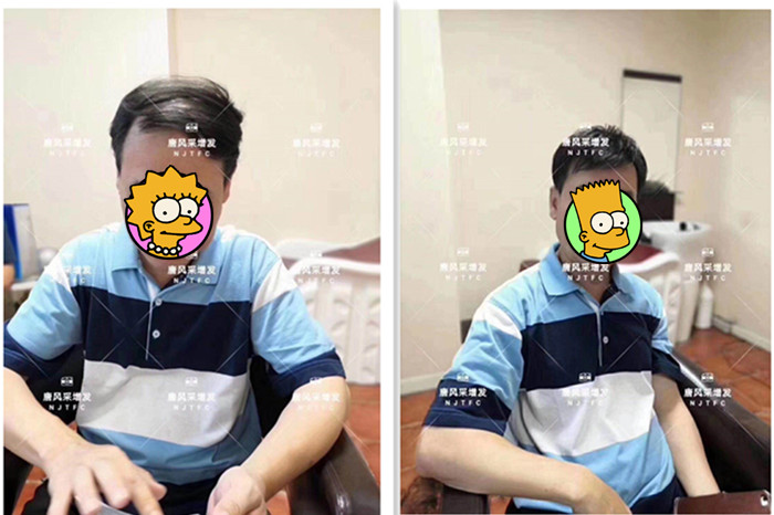 隱形增發(fā) 唐風采真實案例