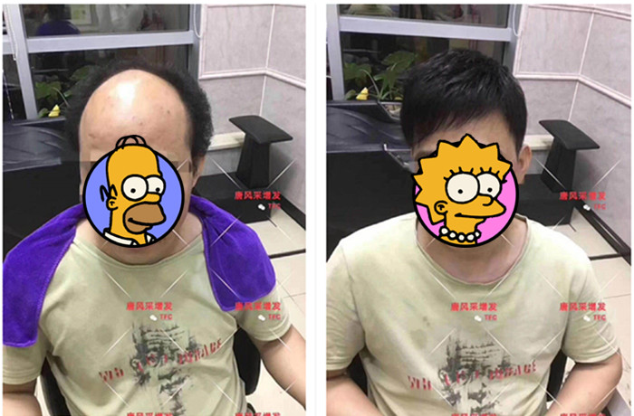 隱形增發(fā) 唐風采真實案例