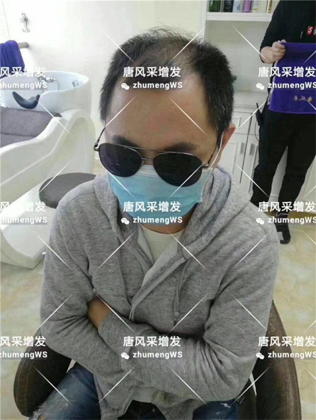 局部假發(fā)片 官方二維碼 唐風(fēng)采客戶案例