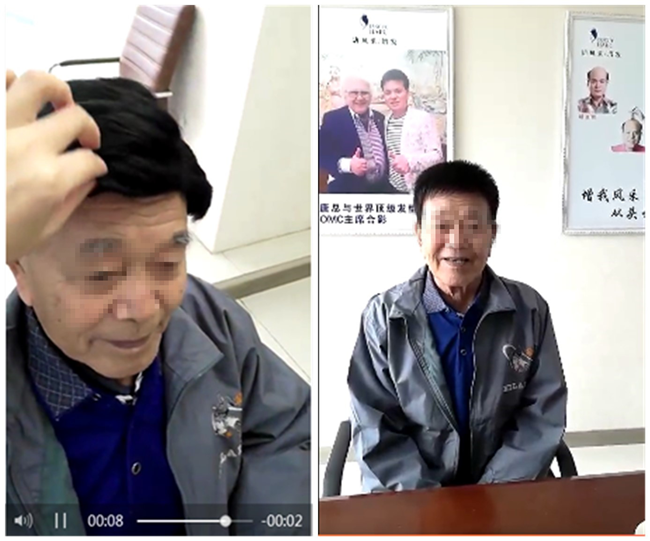 手工制作假發(fā) 一般假發(fā)跟純手工制作假發(fā)差距