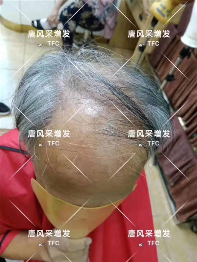 中老年人假發(fā)專賣店 唐風采客戶案例