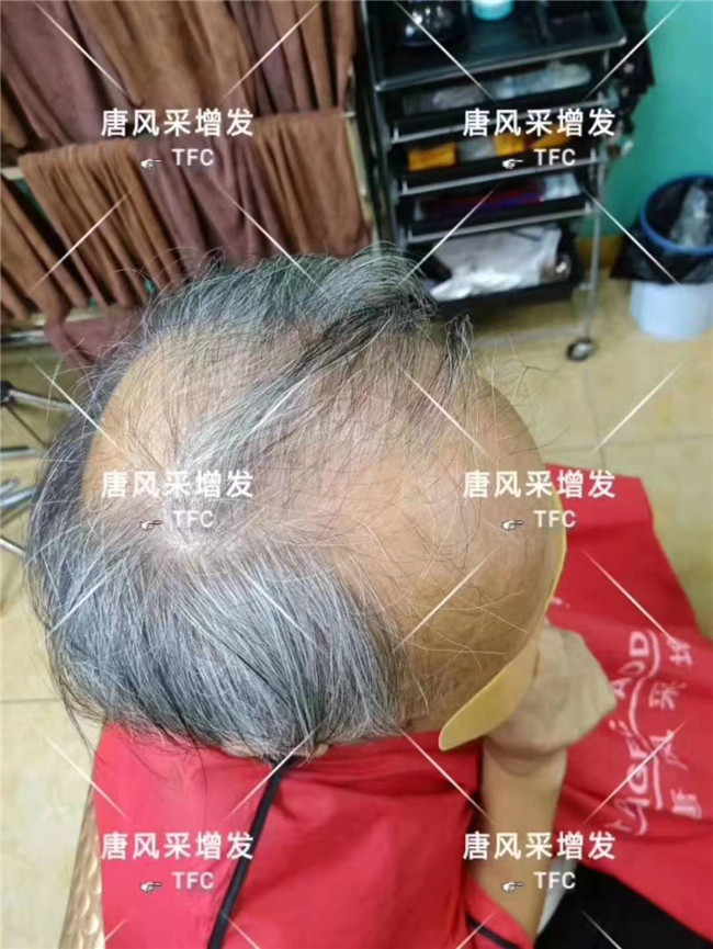 中老年人假發(fā)專賣店 唐風采客戶案例