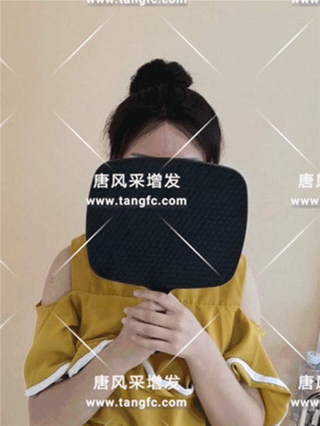 丸子頭導致發(fā)際線越來越高