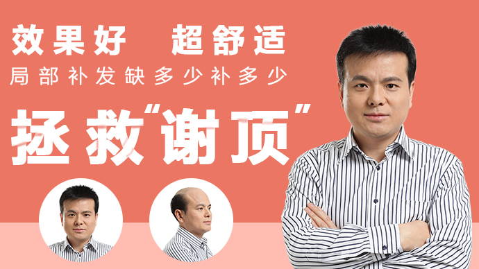 唐風(fēng)采假發(fā)缺多少補多少