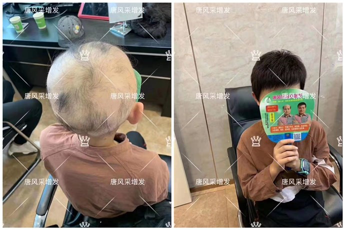 可以選擇到唐風(fēng)采購(gòu)買(mǎi)假發(fā)