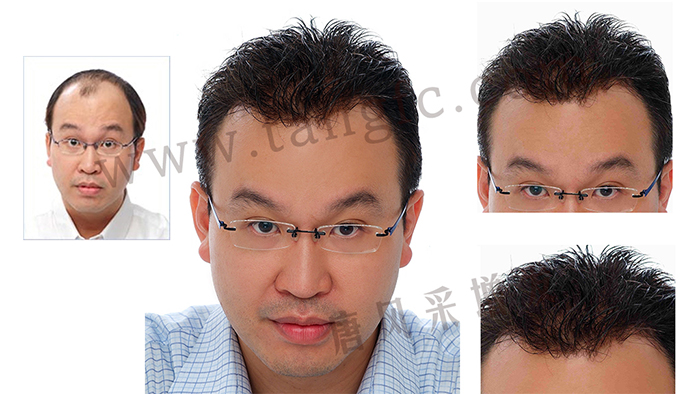 如果你hold不住謝頂，可以來(lái)試試真人頭發(fā)的假發(fā)