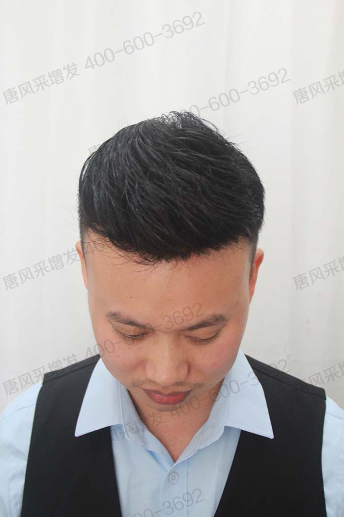 貼在頭頂?shù)募侔l(fā) \